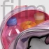 Hello Kitty hologrammos hátizsák, táska 23 cm
